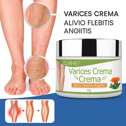 Crema para Eliminar Venas Varices VARICOSE