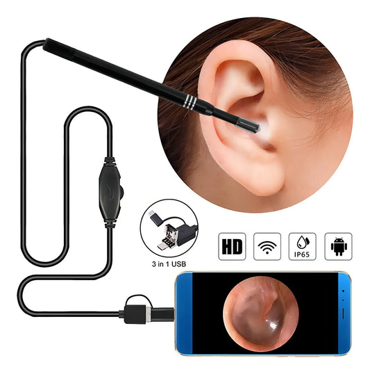 Otoscopio Digital ReTech I98