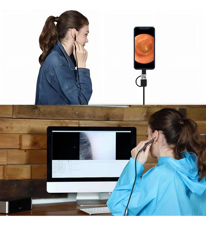 Otoscopio Digital ReTech I98