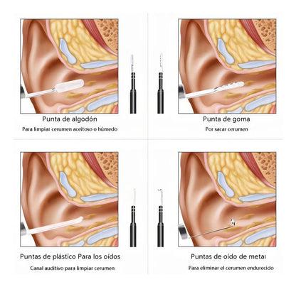 Otoscopio Digital ReTech I98
