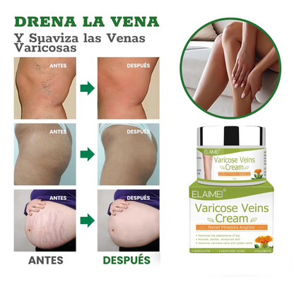 Crema para Eliminar Venas Varices VARICOSE