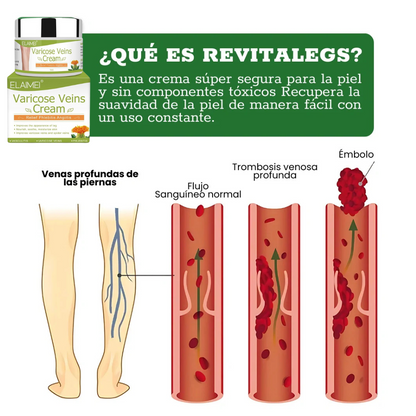 Crema para Eliminar Venas Varices VARICOSE